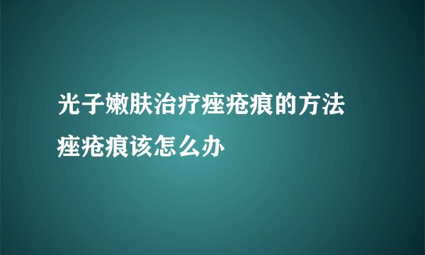光子嫩肤治疗痤疮痕的方法 痤疮痕该怎么办