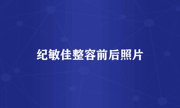 纪敏佳整容前后照片