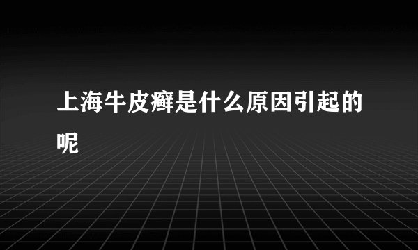 上海牛皮癣是什么原因引起的呢