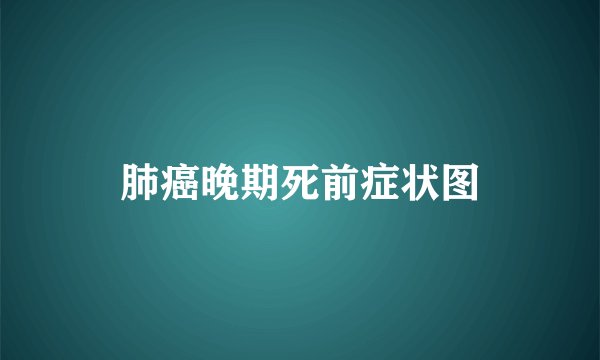 肺癌晚期死前症状图