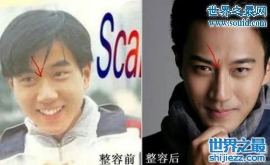 刘恺威整容前后照片曝光,五官全整简直大换脸
