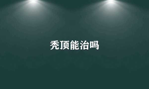 秃顶能治吗