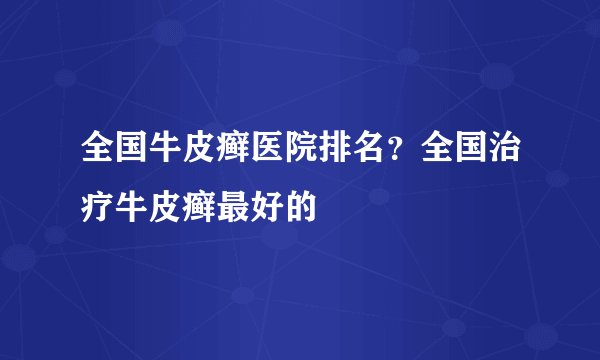 全国牛皮癣医院排名？全国治疗牛皮癣最好的