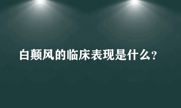白颠风的临床表现是什么？