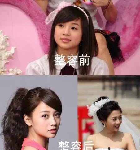 吴映洁为什么叫鬼鬼?整容前后对比照曝光(图)