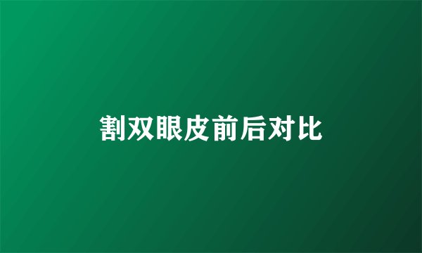 割双眼皮前后对比