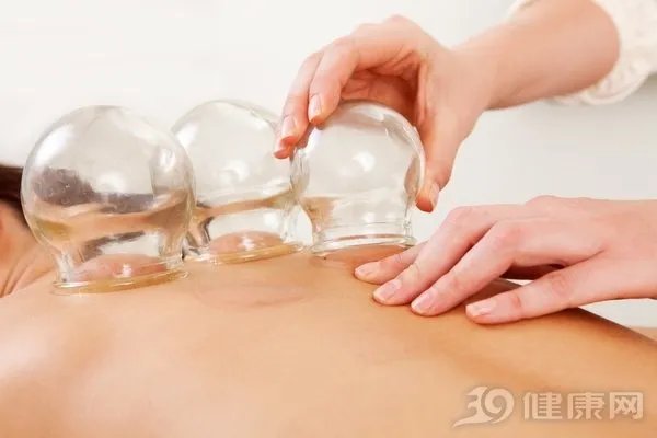 邓莎拔火罐被烧伤:火罐不是人人能拔,注意5个禁忌