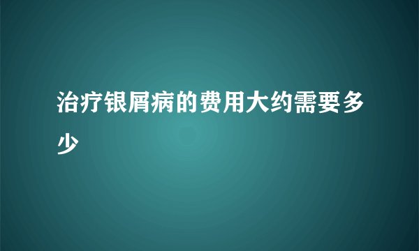 治疗银屑病的费用大约需要多少