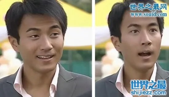 刘恺威整容前后照片曝光,五官全整简直大换脸