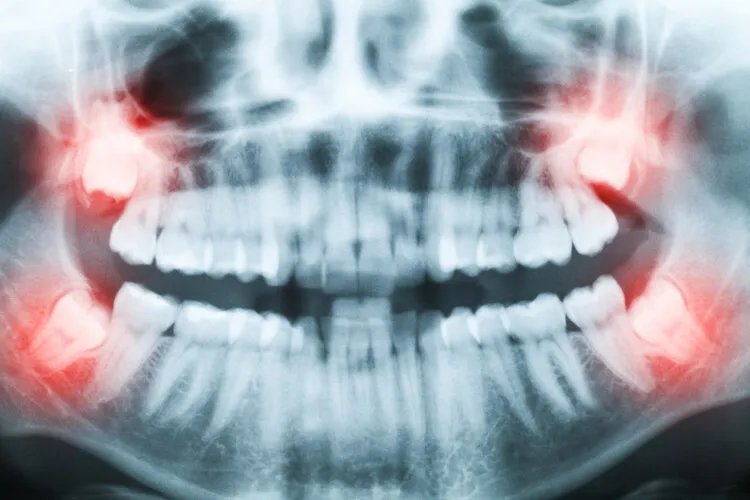 科学家发现：人类进化到现在，身体还存在7个缺陷，你知道几个？