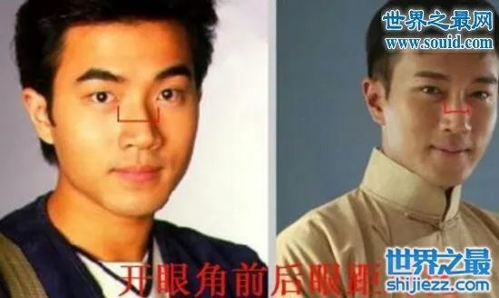 刘恺威整容前后照片曝光,五官全整简直大换脸