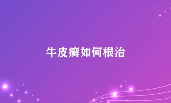 牛皮癣如何根治