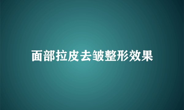 面部拉皮去皱整形效果