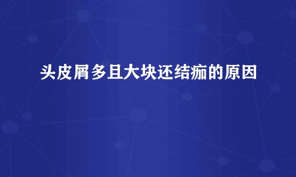 头皮屑多且大块还结痂的原因