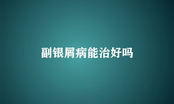 副银屑病能治好吗