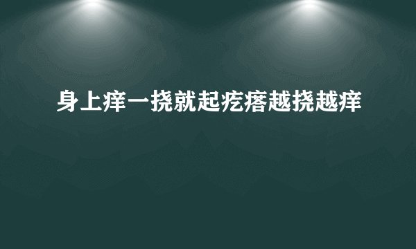 身上痒一挠就起疙瘩越挠越痒