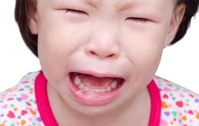 口腔溃疡怎么治好得快