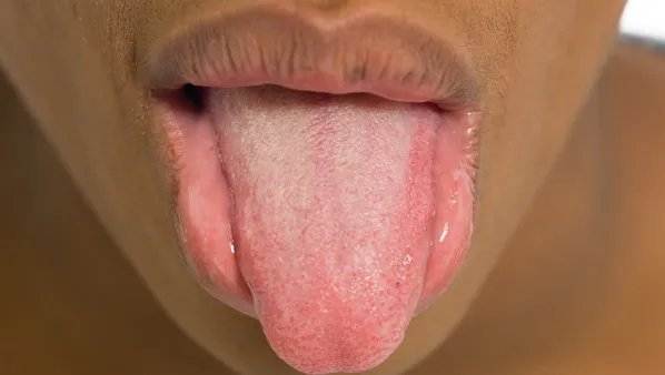 舌头上有小红点怎么回事