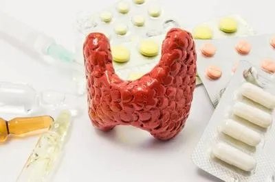 慢性甲状腺炎诊断标准是什么