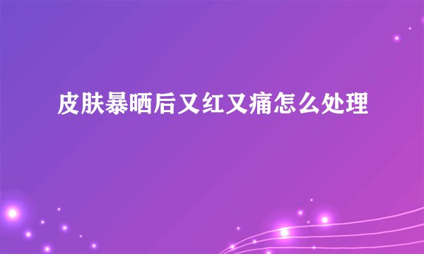 皮肤暴晒后又红又痛怎么处理
