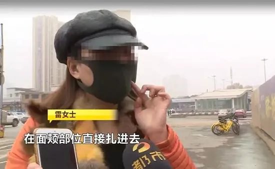 女子脸部整容整出八个坑整形机构人员怎么说?