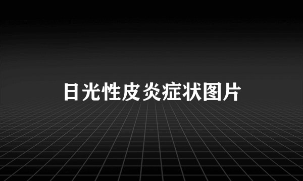 日光性皮炎症状图片