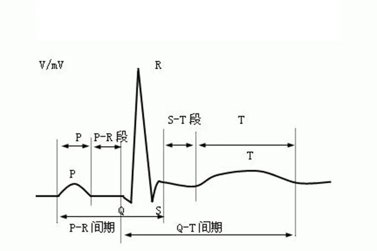 正常的心电图图片