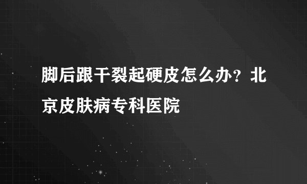 脚后跟干裂起硬皮怎么办?北京皮肤病专科医院