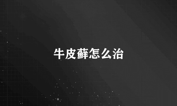 牛皮藓怎么治