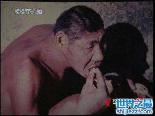 猴娃之谜的真相是什么 科学家表示竟然是这种病