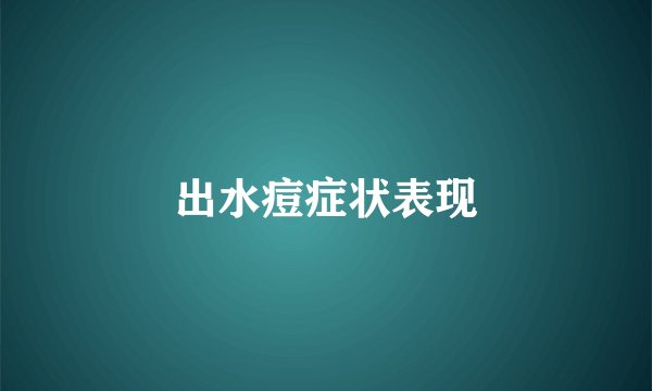 出水痘症状表现