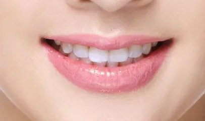 正颌要多少钱