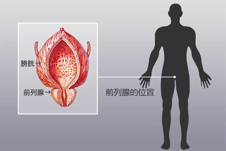 前列腺的位置正面图