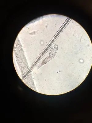 要怎么防止牛脾虫感染