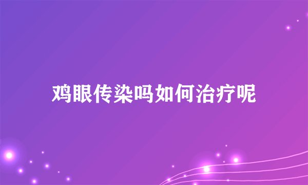 鸡眼传染吗如何治疗呢
