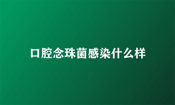 口腔念珠菌感染什么样