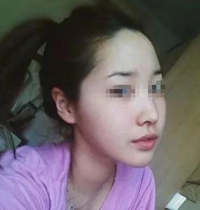 苏州整形医院哪家做面部吸脂好?