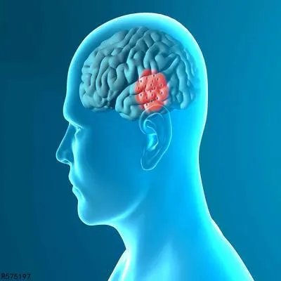 轻微脑栓塞症状有哪些 认识舒血宁注射液