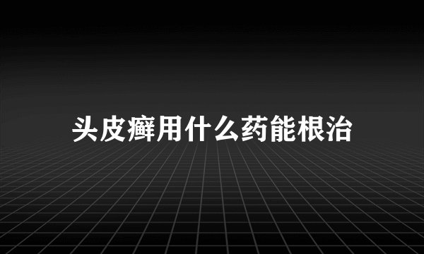 头皮癣用什么药能根治